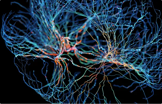 Parkinson's disease psychosis (pdp)